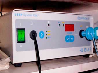 Conizacion leep en consultorio